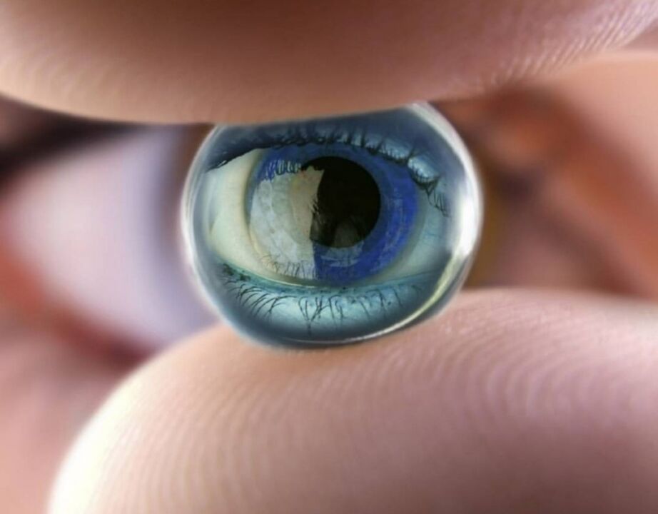 Les lentilles de nuit d'orthokératologie arrêteront la progression de la déficience visuelle